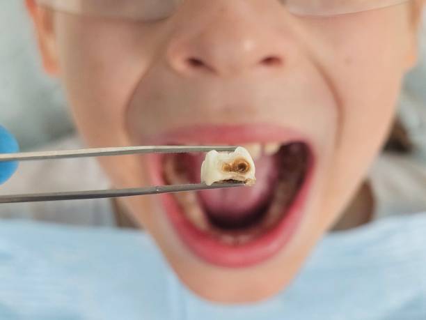 Best Emergency Dental Surgery in Baudette, MN